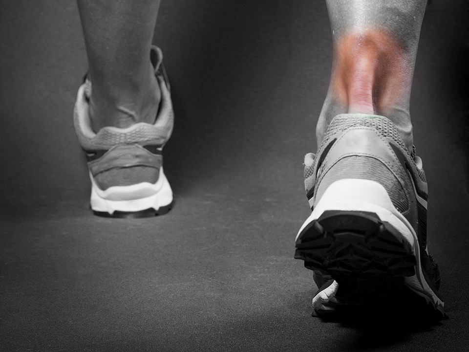 Achilles tendinopathy physiotherapy treatment in Nicosia
