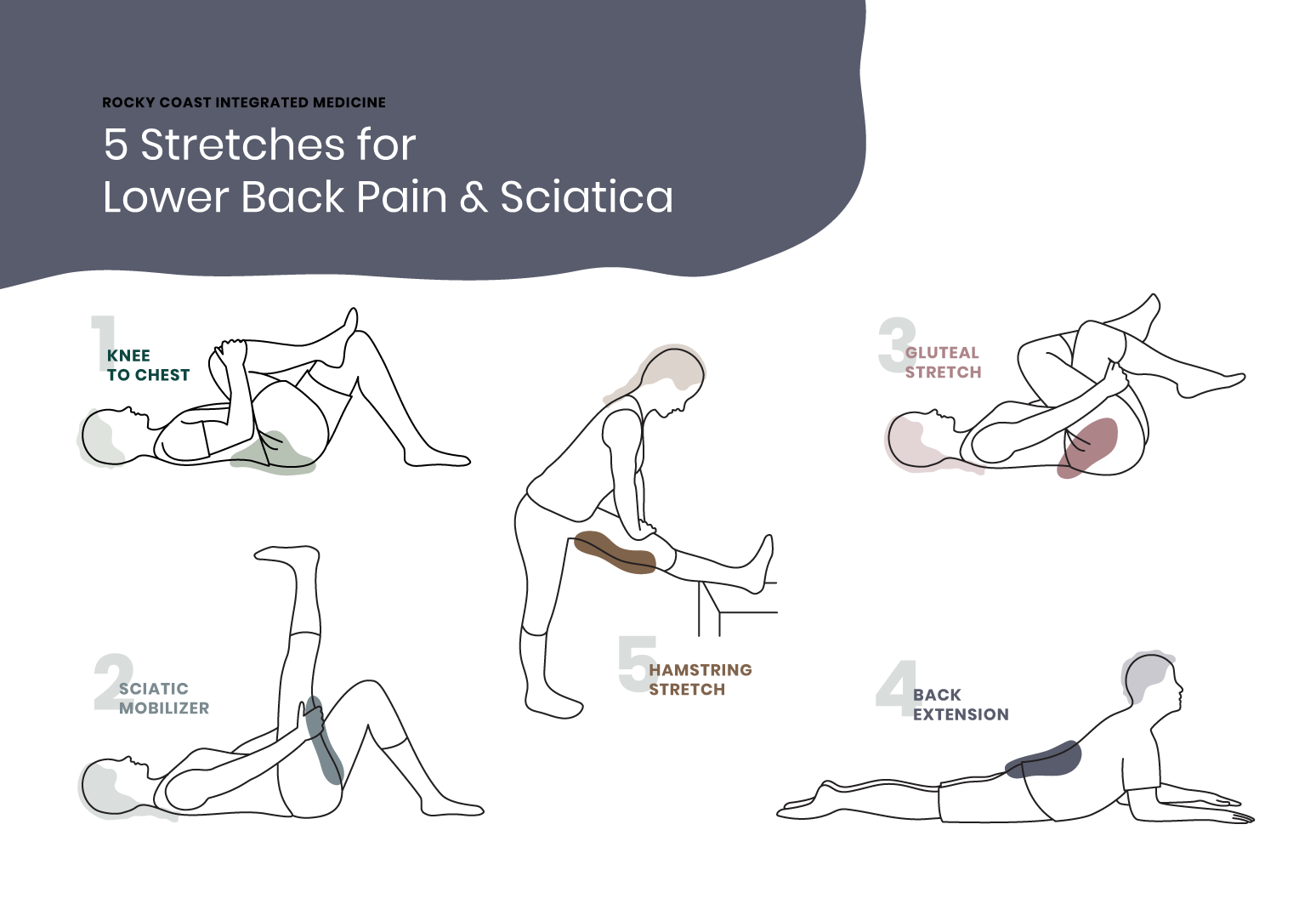 Sciatica rehabilitation exercises in Nicosia