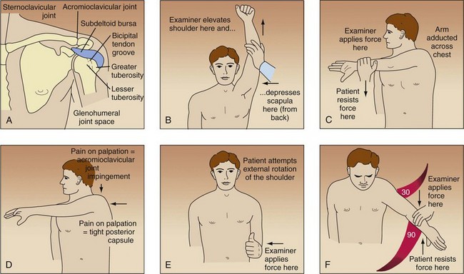 Shoulder pain physiotherapy assessment in Nicosia