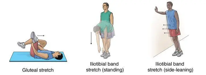 Hip pain physiotherapy assessment in Nicosia