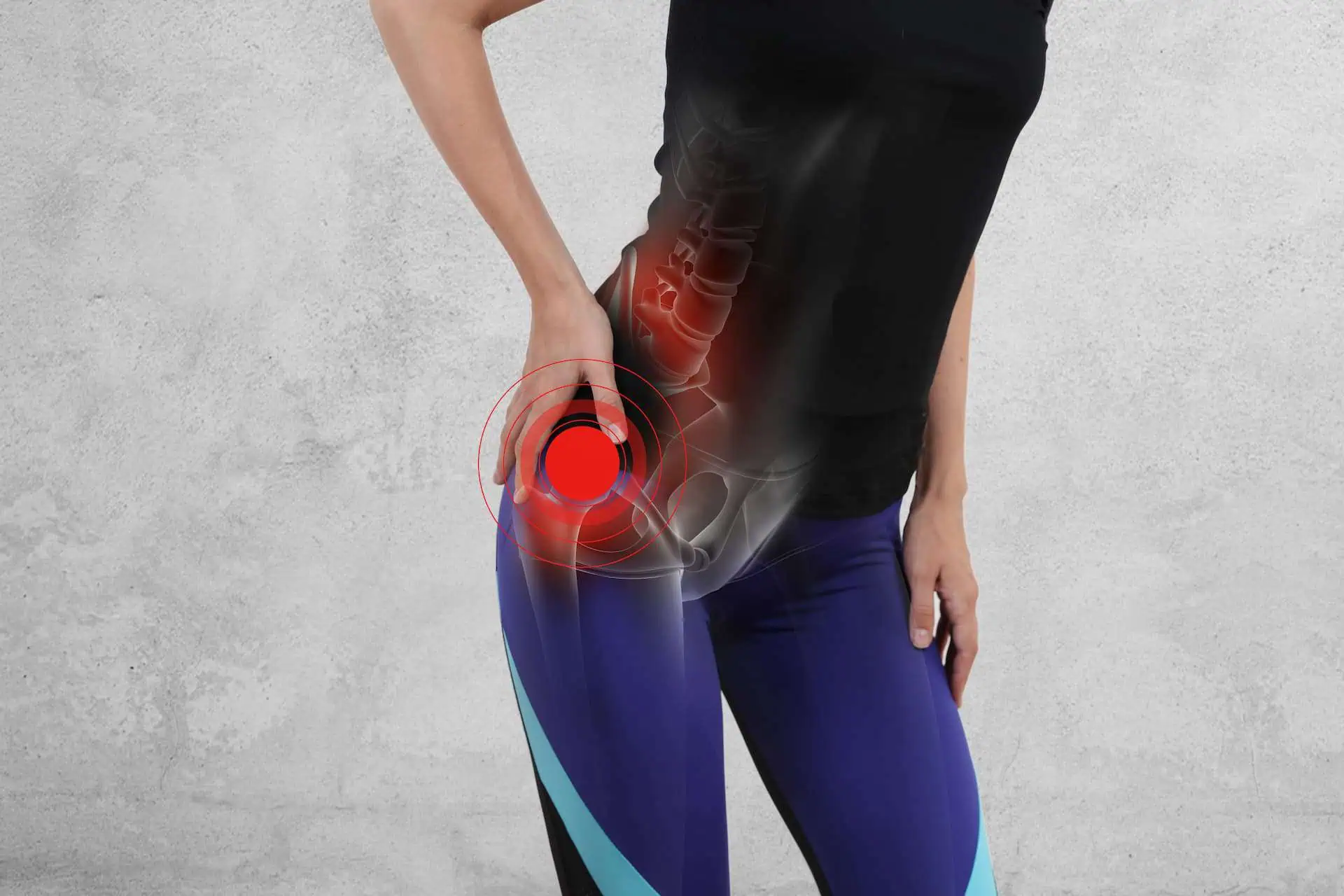 Hip pain physiotherapy treatment in Nicosia