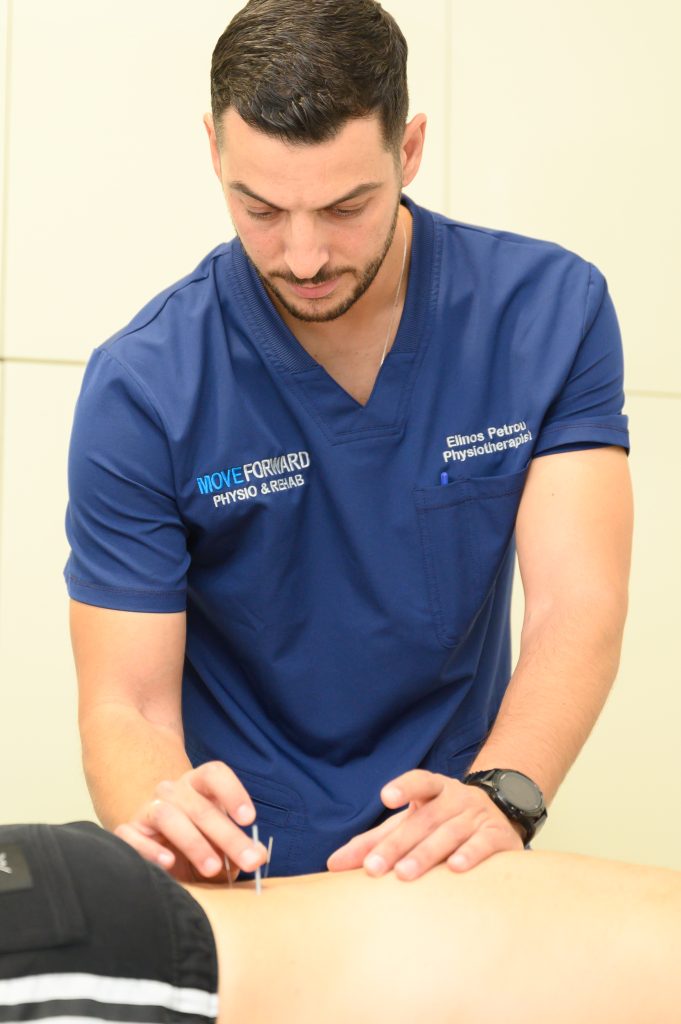 physiotherapist doing acupuncture