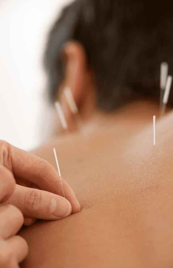 how it the needle look when you use it for acupuncture for back pain