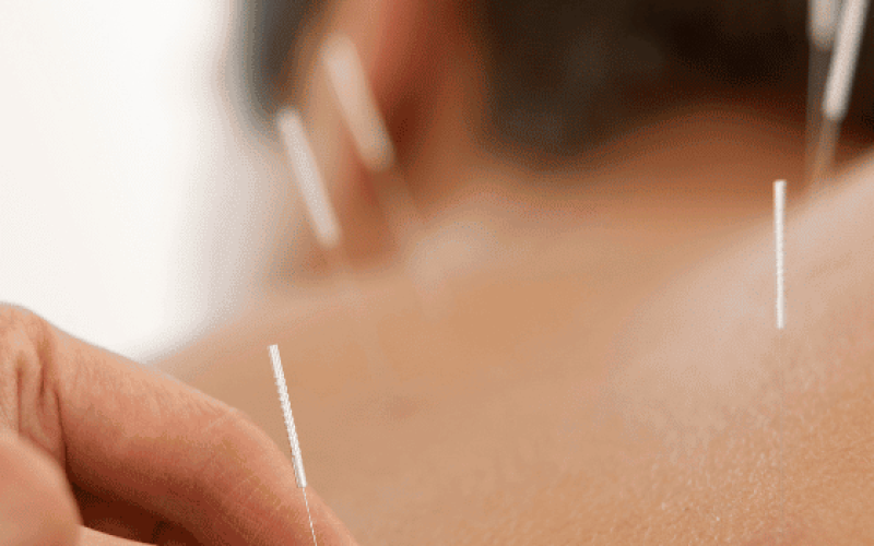 how it the needle look when you use it for acupuncture for back pain